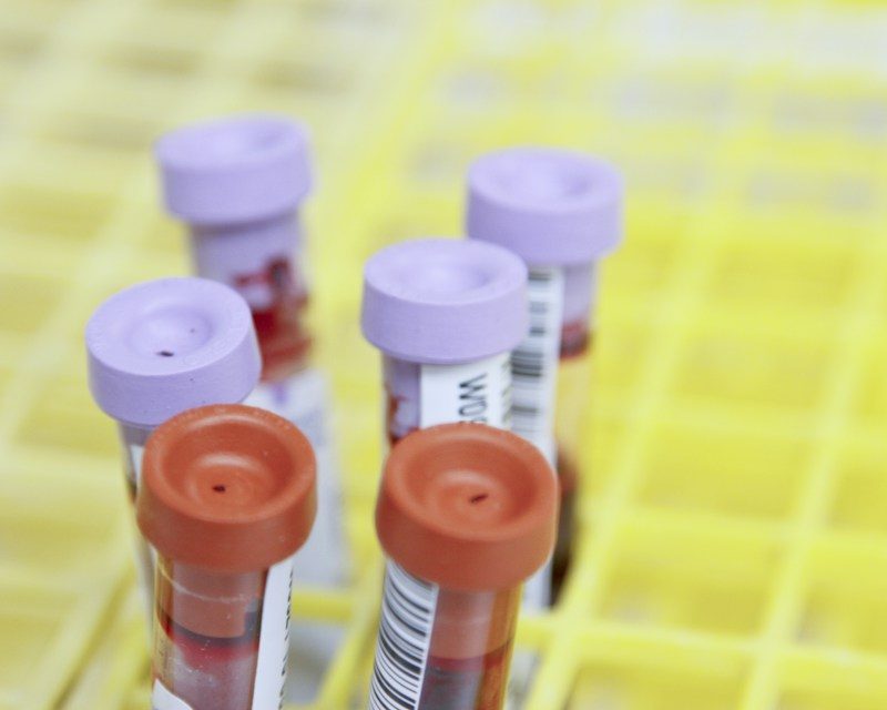 Blood sample tubes in a lab rack